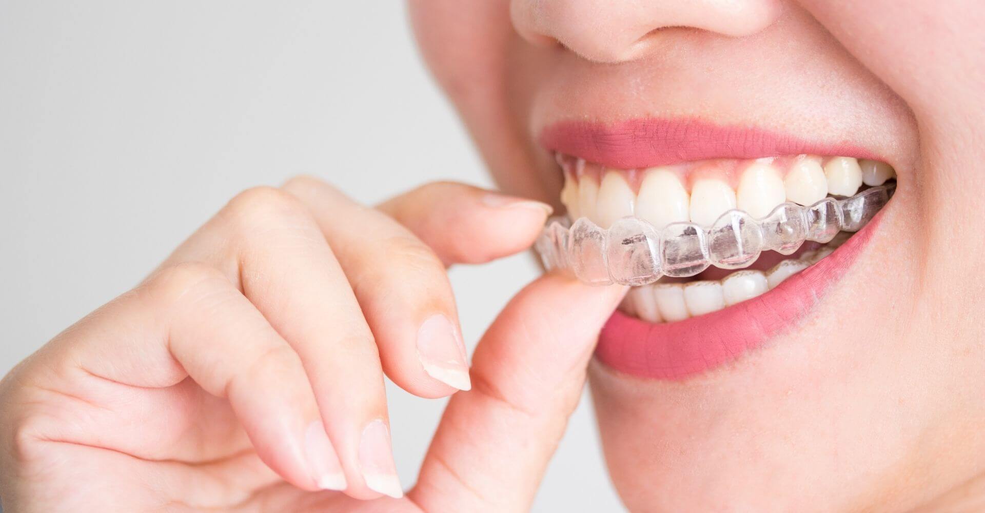 Skyline Dental